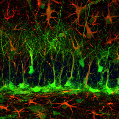Immunostaining of adult hippocampal neural stem cells from Nestin GFP trangenic mice labeling GFAP (orange, mouse) and GFP (orange, 1:1000, chicken, cat co GFP). The confocal image was obtained from a  Leica Sp8 confocal microscope, magnification 40X. Image kindly provided by Soraya Martín Suarez, Achucarro Basque Center for Neuroscience, Spain.
