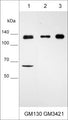 Western blot analysis of GM130 expression in human cells: MCF7 breast carcinoma (lane 1), A549 adenocarcinoma (lane 2), and MDA-MB-231 breast carcinoma (lane 3). The blot was probed with mouse monoclonal anti-GM130 (C-terminal region) at 1:500.