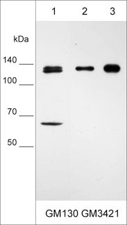 Western blot analysis of GM130 expression in human cells: MCF7 breast carcinoma (lane 1), A549 adenocarcinoma (lane 2), and MDA-MB-231 breast carcinoma (lane 3). The blot was probed with mouse monoclonal anti-GM130 (C-terminal region) at 1:500.