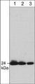 Western blot of rat PC12 cell lysate. The blot was probed with mouse monoclonal anti-Grb2 antibody at 1:250 (lane 1), 1:500 (lane 2), or 1:1000 (lane 3).