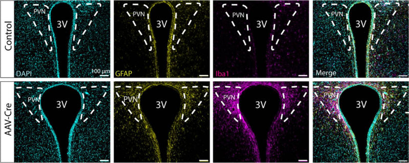 Example comparison of glial fibrillary acidic protein (GFAP) and ionized calcium binding adaptor molecule 1 (Iba1) (cat. IBA1, 1:500) expression in the wild-type paraventricular nucleus of the hypothalamus (PVN) between Control and AAV-Cre mice groups. Image from publication CC-BY-4.0. PMID: 38227343
