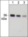 Western blot image of human A431. The Blots were probed with anti-IκBα (C-term.) polyclonal antibody at a dilution of 1:500 (lane 1), 1:1000 (lane 2), and 1:2000 (lane 3).