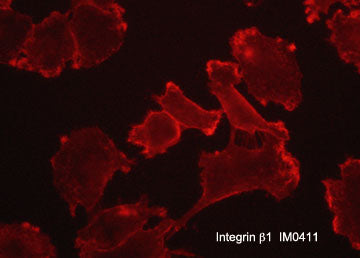 Immunocytochemical labeling of Integrin β1 in aldehyde fixed and NP40 permeabilized human NCI-H1915 lung carcinoma cells. The cells were labeled with mouse monoclonal anti-Integrin β1 (IM0411). The antibody was detected using goat anti-mouse Ig:DyLight® 594.
