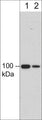 Western blot analysis of human umbilical vein endothelial cells (HUVEC). The blots were probed with mouse monoclonal anti-integrin β3 (IM5811) at 1:250 (lane 1) and 1:1000 (lane 2).