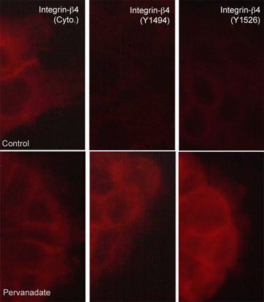 Immunocytochemical labeling of integrin β4 in control (Top) and pervanadate-treated A431 cells (Bottom). The cells were labeled with mouse monoclonal anti-integrin β4 (Cytoplasmic region) (left)  or rabbit polyclonals anti-integrin β4 (Tyr-1494) (middle) or anti-integrin β4 (Tyr-1526) (right), then the antibodies were detected using appropriate secondary antibodies conjugated to DyLight® 594.