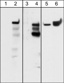 Western blot analysis of A431 cells serum starved overnight (lanes 1, 3, & 5) and treated with pervanadate (1 mM) for 30 min (lanes 2, 4, & 6). The blots were probed with rabbit polyclonal anti-Integrin β4 (Tyr-1526) (lanes 1 & 2) and anti-Integrin β4 (Tyr-1494) (lanes 3 & 4) or with mouse monoclonal anti-Integrin β4  (lanes 5 & 6).