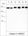 Western blot analysis of integrin β1 expression in native human cells and tissues: A549 (lane 1) LNCaP (lane 2), MDA-MB-231 (lane 3) breast (lane 4), lung (lane 5), and skin (lane 6). The blot was probed with mouse monoclonal anti-Integrin β1 (IM0321) at 1:1000 dilution.