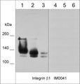 Western blot analysis of native (lanes 1-3) and denatured (lanes 4-6) cell lysates from human A431 (lane 1 & 4), A549 (lane 2 & 5), and LNCaP (lane 3 & 6). The blots were probed with mouse monoclonal anti-Integrin β1 (IM0041) at 1:1000 dilution.