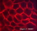 Immunocytochemical labeling of Integrin β1 in paraformaldehyde fixed human A431 cells. The cells were labeled with mouse monoclonal anti-Integrin β1 (clone M006). The antibody was detected using goat anti-mouse DyLight® 594.