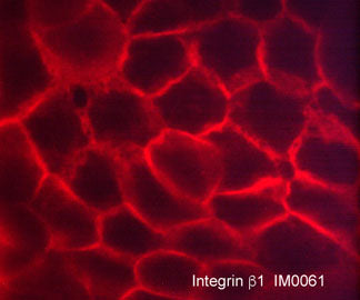 Immunocytochemical labeling of Integrin β1 in paraformaldehyde fixed human A431 cells. The cells were labeled with mouse monoclonal anti-Integrin β1 (clone M006). The antibody was detected using goat anti-mouse DyLight® 594.