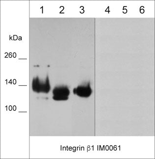 Western blot analysis of native (lanes 1-3) and denatured (lanes 4-6) cell lysates from human A431 (lane 1 & 4), A549 (lane 2 & 5), and MDA-MB-231 (lane 3 & 6). The blots were probed with mouse monoclonal anti-Integrin β1  (IM0061) at 1:1000 dilution.