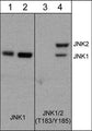 Western blot analysis of PC12 cells untreated (lanes 1 & 3) or treated with calyculin A (100 nM) for 30 minutes (lanes 2 & 4). The blot was probed with anti-JNK1 (lanes 1 & 2) or anti-JNK1 (T183/Y185) (lanes 3 & 4).