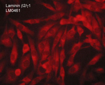 Immunocytochemical labeling of laminin β2/γ1 subunits in aldehyde fixed and NP-40 permeabilized human MDA-MB-231 breast carcinoma cells. The cells were labeled with mouse monoclonal anti-Laminin β2/γ1 subunits (LM0461). The antibody was detected using goat anti-mouse DyLight® 594.
