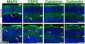 Immunostaining of control and Emx1Cre;CasTcKO coronal sections for MZ and SP (white arrows) markers at E15.5. MAP2 (Cat. MAP, 1:500), CSPG, Calretinin, and Calbindin show clustering of cells (yellow arrows). CSPG+ cells form a column connecting the SP with