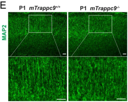 MAP2 (cat. MAP) immunostaining of neonatal (P1) mouse cerebral cortex showing a significant decrease in the area ratio of MAP2 fluorescence. Image from publication CC-BY-4.0. PMID:37416774