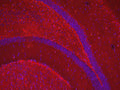 MBP: frozen sections; all washes with Triton 0.5%; Region: Striatum; Blocking: BlockHen 1%; Secondary antibody: anti-chicken FITC (Aves); Epifluorescence microscope; 40x magnification.