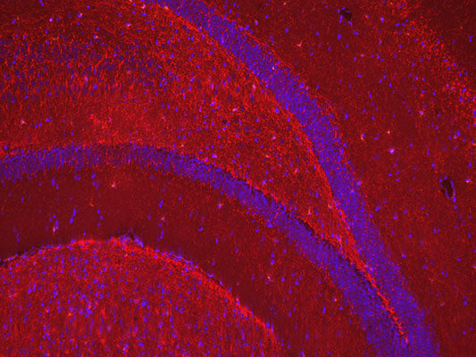 Immunostaining in the cortical and hippocampal region of paraffin embedded transgenic adult mouse brain identifying MBP (Cat no MBP, 1:1000, red) with nuclear staining with DAPI. Images taken with an epifluorescence microscope, 10x magnification. Image kindly provided by Begüm Kurt, Achucarro Basque Center for Neuroscience.