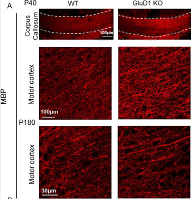 Representative images are for myelin basic protein, MBP (cat. MBP 1:250; red), staining in corpus callosum and motor cortex of wildtype and GluD1 KO mice at P40 and P180 and its quantification. GluD1 KO mice showed increased MBP staining in corpus callosum (*p = 0.0196, unpaired t-test) and motor cortex (****p < 0.0001, unpaired t-test) at P40. Image from publication CC-BY-4.0. PMID:37983226