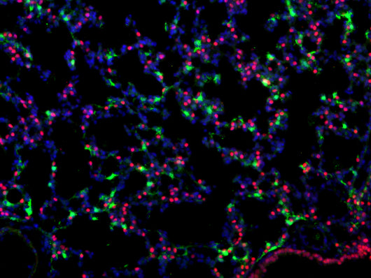 Immunostaining of postnatal day 12 Scube2-CreER ROSA26-tdTomato mouse lung tissues fixed in 4% paraformaldehyde and paraffin embedded (FFPE) showing specific detection of tdTomato in the mesenchyme using mCherry (cat. MCHERRY, 1:100; green). Nkx2.1 (red) marks the epithelium and nuclei are labeled with DAPI (blue). Image kindly provided by Erica Yao, University of California San Francisco).