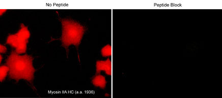 Immunocytochemical labeling of Slingshot-1L in rat PC12 cells differentiated with NGF. The cells were labeled with rabbit polyclonal anti-Myosin IIA Heavy Chain (a.a. 1936-1950), then detected using appropriate secondary antibody conjugated to Cy3. The antibody was used in the absence (left) or presence (right) of blocking peptide (MX3795).