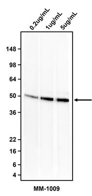 Western blotting of MCF7 cell lysate using 0.2 ug/mL, 1 ug/mL, or 5 ug/mL  mouse anti-Cytokeratin-18 (CK18) antibody (MM-1009). MM-1009 mouse anti-CK18 antibody recognizes endogenous CK18 at ~48 kDa.