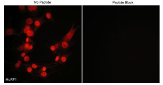 Immunocytochemical labeling of MuRF1 in mouse C2C12 cells. The cells were labeled with rabbit polyclonal MuRF1 antibody, then detected using appropriate secondary antibody conjugated to Cy3. The antibody was used in the absence (left) or presence (right) of blocking peptide (MX3405).