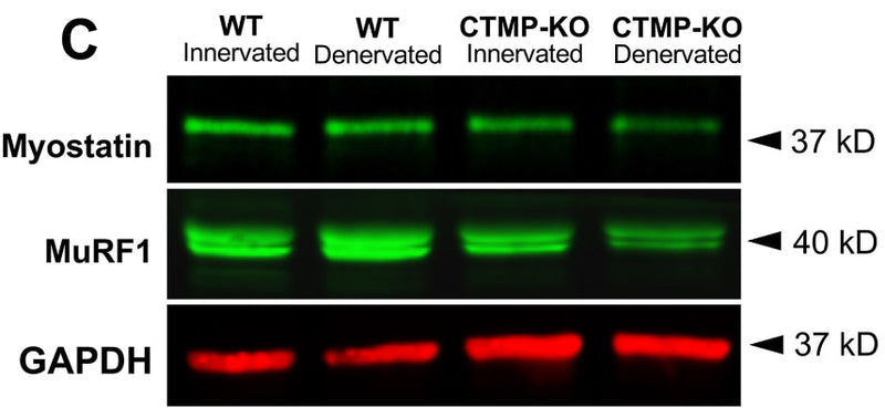Markers for muscle degeneration, Myostatin and MuRF-1 (cat. MP3401, 1:1000), were significantly less expressed in CTMP-KO gastrocnemius muscle compared to WT mice. Image from publication CC-BY-4.0. PMID: 36652767