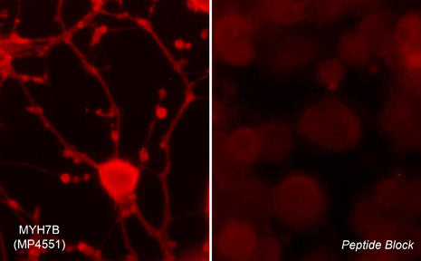 Immunocytochemical labeling of MYH7B in rat PC12 cells differentiated with NGF. The cells were probed with MYH7B (Hinge region) rabbit polyclonal antibody (MP4551) in the absence (left) or presence (right) of blocking peptide (MX4555). The antibody was detected using appropriate secondary antibody conjugated to DyLight® 594.