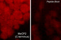 Immunocytochemical labeling of MeCP2 in rat PC12 cells differentiated with NGF. The cells were probed with MeCP2 (C-terminus) rabbit polyclonal antibody (MP4591) in the absence (left) or presence (right) of blocking peptide (MX4595). The antibody was detected using appropriate secondary antibody conjugated to DyLight® 594.