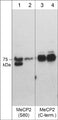 Western blot of adult mouse brain tissue lysate. The blot lanes were untreated (lanes 1 & 3) or treated with lambda phosphatase (lanes 2 & 4) then probed with rabbit polyclonals anti-MeCP2 (Ser-80) (lanes 1 & 2) or anti-MeCP2 (C-terminus) (lanes 3 & 4).