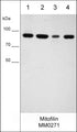 Western blot analysis of human cell lysates: MeWo (lane 1), MDA-MB-231 (lane 2), PC3 (lane 3), and A549 (lane 4). The blot was probed with mouse monoclonal anti-mitofilin (MM0271) at 1:1000.