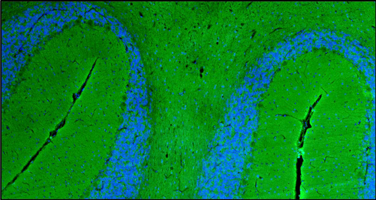 Representative section of formalin fixed, paraffin-embedded rat brain cerebellum region showing staining of NCAM1. The sections were stained with anti-NCAM1 chicken polyclonal antibody (visualized in green) at 1 µg/mL (1:200) dilution. The stained sections were mounted with Antibodies Incorporated FluoroshieldTM with DAPI and DABCO mounting medium (Cat no. AR-6505). DAPI nuclear stain (blue) shows cell nuclei. Magnification 100X.