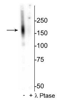 Western blot of mouse kidney lysate showing specific immunolabeling of the ~160 kDa NCC protein phosphorylated at Thr53 in the first lane (-). Phosphospecificity is shown in the second lane (+) where immunolabeling is completely eliminated by blot treatment with lambda phosphatase (λ-Ptase, 1200 units for 30 min).