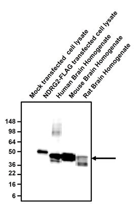 Western blotting of mock or NDRG2-FLAG transfected COS-7 cell lysates and human, mouse, and rat brain homogenates (10 ug/lane) with Aves Labs chicken anti-NDRG2 antibody (0.2 ug/ml) and detected with anti-chicken HRP. Anti-NDRG2 recognizes endogenous NDRG2 in brain homogenates in addition to exogenous NDRG2 in COS-7 cells.