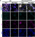 Immunofluorescence for pY165Cas (cyan), c-Myc (magenta), and Nestin (Cat. NES, 1:500; blue) of WT and Emx1Cre;β1-Integrinflox/flox mixed cortical cultures transfected with a control vector (myc) or a construct overexpressing myc-tagged