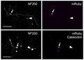 Confocal micrographs of caldendrin KO cultures infected with AAV-mRuby (top) or AAV-mRuby-caldendrin (bottom) showing immunolabeling for NF200 (Cat. NFH, 1:1000, left) and mRuby (right). NF200-positive DRGNs with and without mRuby fluorescence are indicated by arrows and arrowheads, respectively. Scale