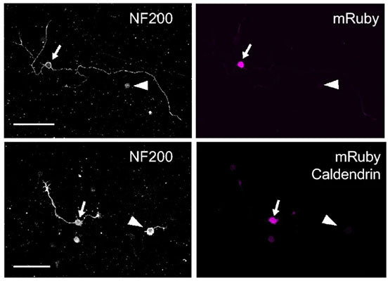 Confocal micrographs of caldendrin KO cultures infected with AAV-mRuby (top) or AAV-mRuby-caldendrin (bottom) showing immunolabeling for NF200 (Cat no. NFH, 1:1000, left) and mRuby (right). NF200-positive DRGNs with and without mRuby fluorescence are indicated by arrows and arrowheads, respectively. Scale bar, 100 µm. Image from publication CC-BY-4.0. PMID:36788334