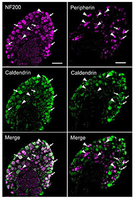 Confocal micrographs of DRG cryosections from WT mouse double-labeled with antibodies against caldendrin (green) and NF200 (Cat no. NFH, 1:1000, purple) or peripherin (Cat no. PER, 1:1000, purple). Arrows and arrowheads indicate cells in which caldendrin is or is not, respectively, co-localized with NF200 or peripherin. Results are representative of at least 3 independent experiments. Scale bar, 100 µm. Image from publication CC-BY-4.0. PMID:36788334