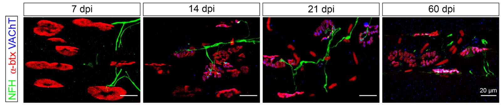 Af/nf Chain Anti-NFH (Neurofilament Heavy Chain) Antibody | NFH