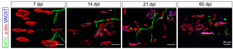 Representative images of sections of a rat G muscle 7, 14, 21, and 60 dpi, immunostained against NFH (cat. NFH, 1:200; green), α-btx (red), and VAChT (blue), respectively, to label axons, neuromuscular junctions, and the synaptic vesicle-filled motor end plate. Larger numbers of reinnervated NMJs were observed with increased time after injury, with almost complete innervation at 60 dpi. The nicotinic receptor field expands after early denervation. Image from publication CC-BY-4.0. PMID: 36759186
