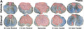 Representative images of mouse spinal cord throughout the rostral-caudal extent of injury 42 days after spinal cord injury (SCI). Sections are stained for myelin (blue, erichrome cyanine) and axons (brown, neurofilament, cat. NFH, 1:1500). Frank lesion areas are highlighted in red. Spared tissue is evident by both blue and brown staining. Image from