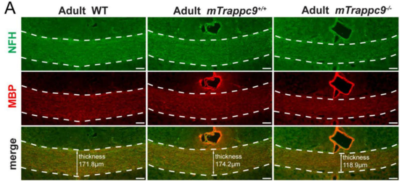 NFH (axonal tracts, cat. NFH) and MBP (myelin) immunostaining of the corpus callosum sections. Compared with WT (C57BL/6 wildtype) and mTrappc9+/+, the corpus callosum (highlighted with white dotted lines) of mTrappc9m/m mice was significantly thinner. Image from publication CC-BY-4.0. PMID:37416774