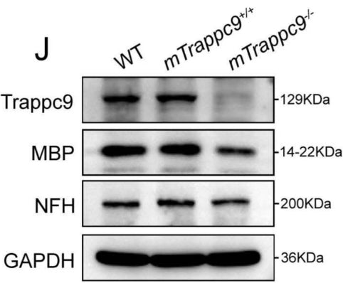 Western blot analysis of MBP and NFH protein expression in cerebral cortex normalized with GAPDH. Both showed a significant decrease in mTrappc9 m/m mice. Image from publication CC-BY-4.0. PMID:37416774