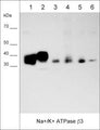 Western blot of native human MDA-MB-231 (lane 1), and MeWo (lane 2) cell lysates, as well as native human breast (lane 3), lung (lane 4), skin (lane 5), and brain (lane 6) tissues. The blot was probed with anti-Na+/K+ ATPase β3 (NM0251) at 1:1000.