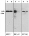 Western blot analysis of human umbilical vein endothelial cells stimulated with pervanadate (1 mM) for 30 min. (lanes 1, 3, & 5) then the blot was treated with alkaline phosphatase (lanes 2, 4, & 6). The blots were probed with anti-eNOS monoclonal antibody (NM2211; lanes 1 & 2), anti-eNOS (Tyr-657) phospho-specific antibody (NP4031; lanes 3 & 4), or anti-eNOS polyclonal antibody (NP2281; lanes 5 & 6).