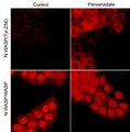 Immunocytochemical labeling of N-WASP in control and pervanadate-treated A431 cells. The cells were labeled with rabbit polyclonal N-WASP/WASP (WP2101) or rabbit polyclonal N-WASP (Tyr-256) antibodies, then the antibodies were detected using appropriate secondary antibody conjugated to DyLight® 594.