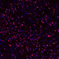 Immunostaining of Olig 2 in 3-month-old mouse brain Olig 2: Red; Nuclear: Blue. Image courtesy of Mengmeng Jin, Rutgers University.