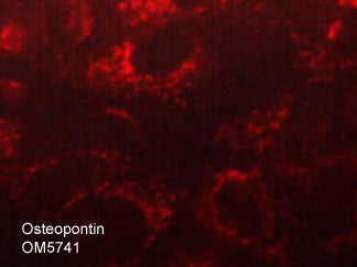 Immunocytochemical labeling of Osteopontin in paraformaldehyde fixed and NP-40 permeabilized MCF-7 cells. The cells were labeled with mouse monoclonal anti-Osteopontin (M574). The antibody was detected using goat anti-mouse DyLight® 594.
