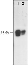 Western blot image of mouse brain (lane 1) and human A431 cells (lane 2). The blot was probed with anti-PDK1 (C-terminal region) (PM1461).