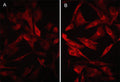 Immunocytochemical labeling of PD-L1 in aldehyde fixed human MDA-MB-231 carcinoma cells untreated (A) or treated with 100 ng/ml IFNγ for 48 hrs (B). The cells were labeled with mouse monoclonal anti-PD-L1 (PM0511). The antibody was detected using goat anti-mouse DyLight® 594.